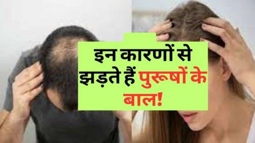 Hair Loss Cause : इन कारणों से झड़ते हैं पुरूषों के बाल!