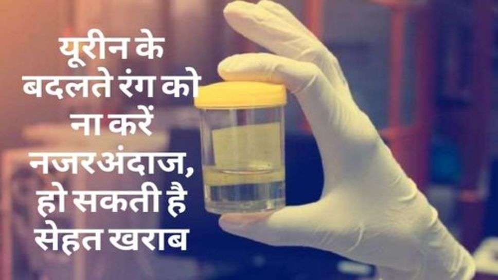 Health Tips : यूरीन के बदलते रंग को ना करें नजरअंदाज, हो सकती है सेहत खराब