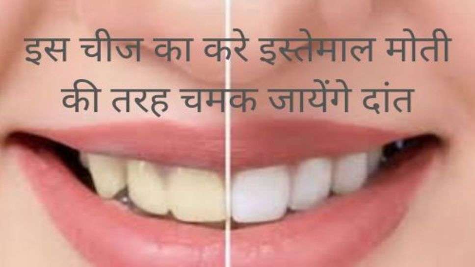 Teeth Tips : इस चीज का करे इस्तेमाल मोती की तरह चमक जायेंगे दांत