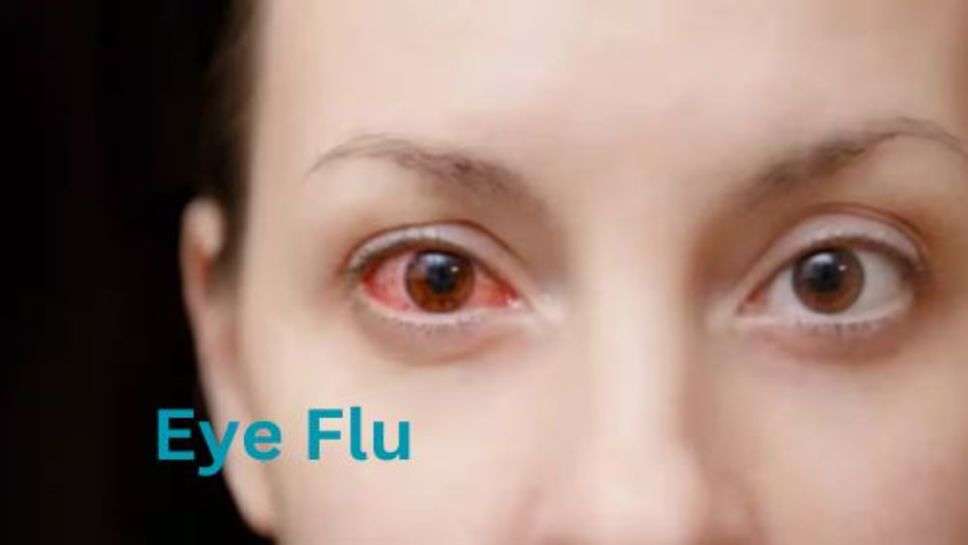 Eye Flu: भारत के कई राज्यों में बढ़ रहा तेजी से आई फ्लू