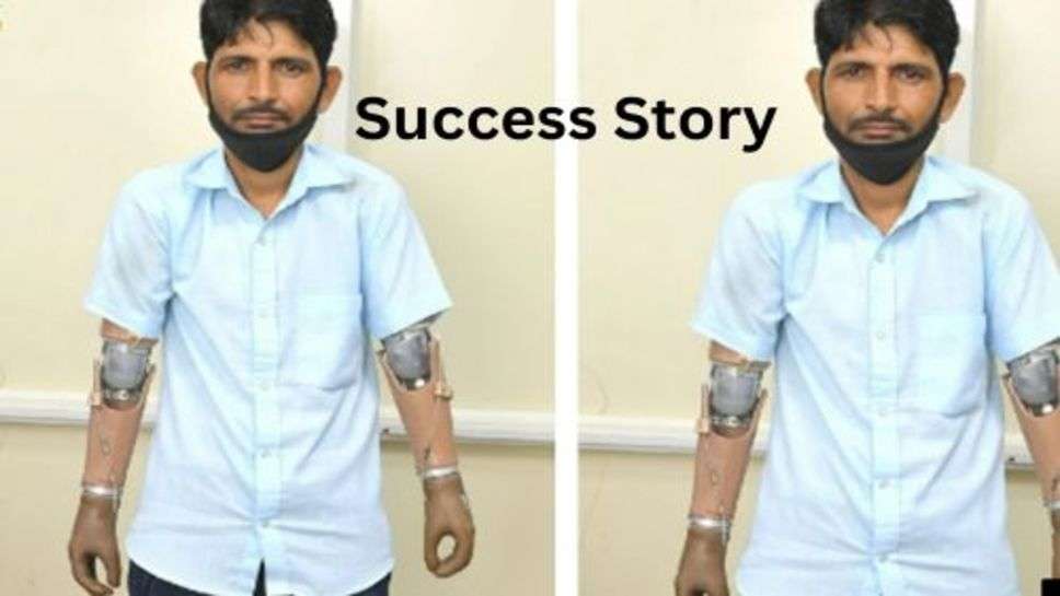 Success Story: दोनों हाथ गंवाने के बाद पैरों से लिख दी जीवन में सफलता की कहानी