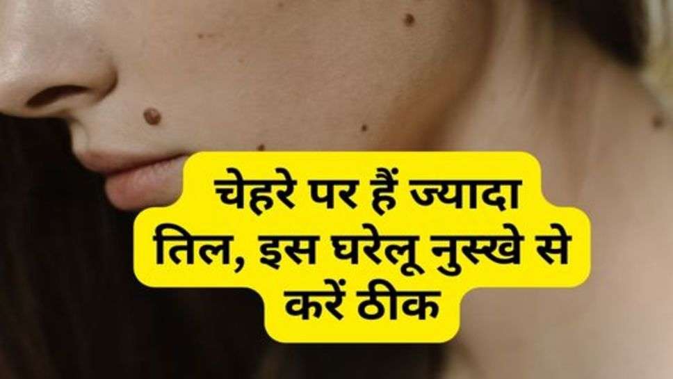 Mole Removal On Face : चेहरे पर हैं ज्यादा तिल, इस घरेलू नुस्खे से करें ठीक