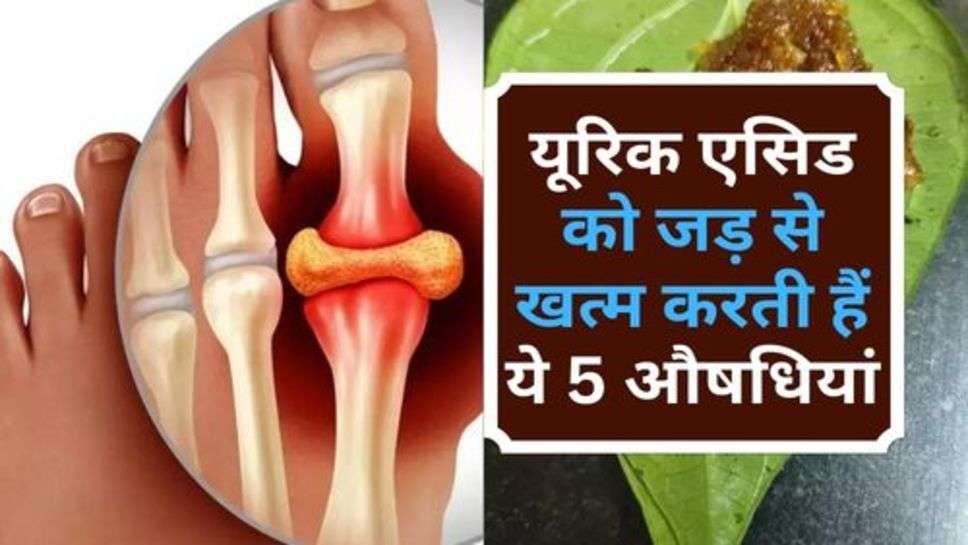 Uric Acid : यूरिक एसिड को जड़ से खत्म करती हैं ये 5 औषधियां, आज ही करें इस्तेमाल