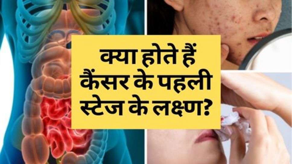 Cancer : क्या होते हैं कैंसर के पहली स्टेज के लक्ष्ण?