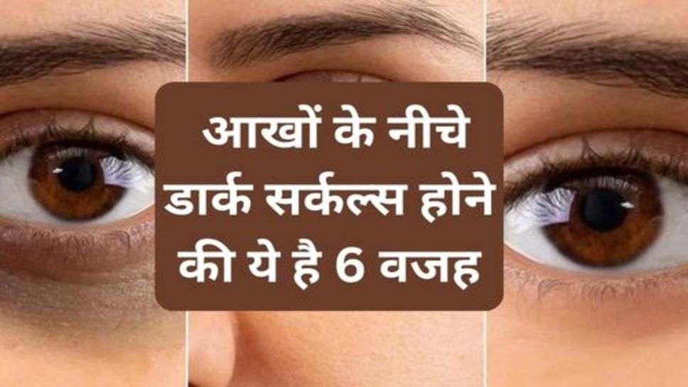 Skin Care Tips : आखों के नीचे डार्क सर्कल्स होने की ये है 6 वजह, जानें दूर करने के उपाय