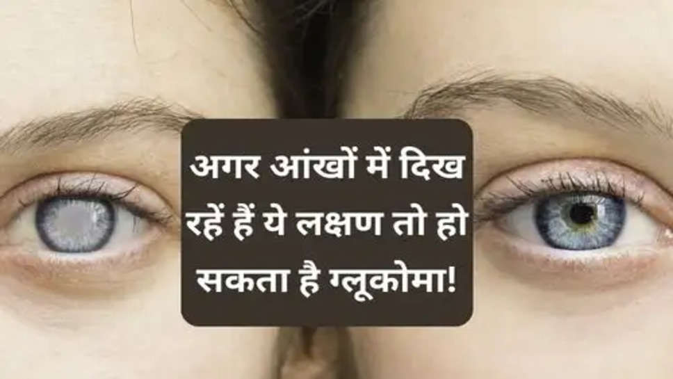 Eye Health Tips  :   अगर आंखों में दिख रहें हैं ये लक्षण तो हो सकता है ग्लूकोमा!